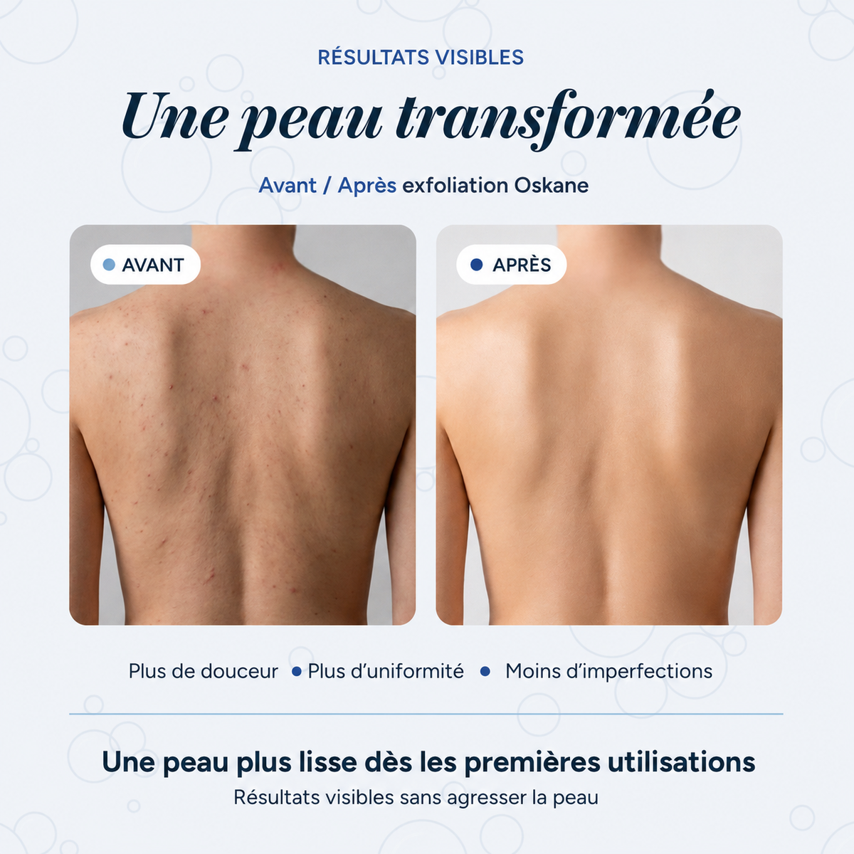 Serviette de douche exfoliante Oskane